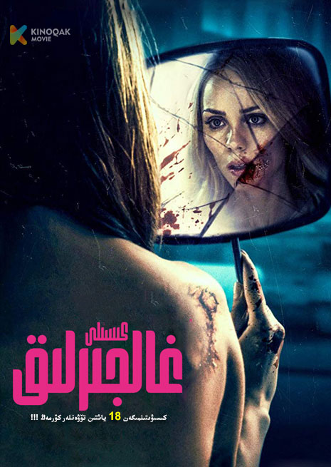 غالجرلىق كىسىلى | No18